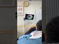 耳垢そうじ/耳が痒くなった鼓膜に付着した軟耳垢/ #shorts