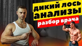 Дикий Лось. Разбор анализов от врача.