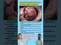 डिलीवरी के दौरान डिलीवरी रूम में किन किन बातों पर ध्यान रखें ? Pregnancy tips #viral #education