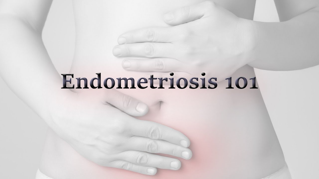 What is Endometriosis? YouTube