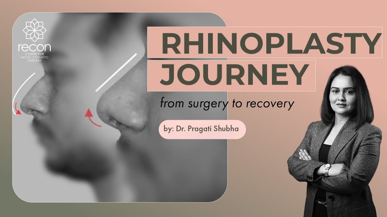 Rhinoplasty Journey | Rhinoplasty Before and After