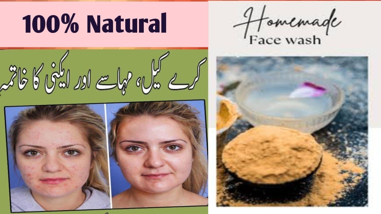 how to make your own herbal acne face wash to remove dark spots.pimples