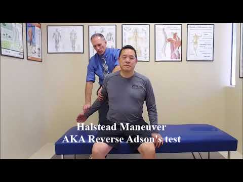 Halstead Maneuver AKA Reverse Adson's Test - YouTube
