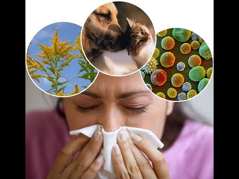 allergia-ellen-test-nk-eg-szs-g-nk-di-ta