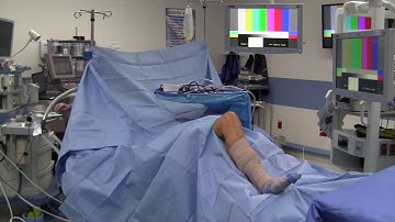 Diagnostic Knee Arthroscopy and Partial Meniscectomy: Positioning and Portal Creation