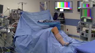 Diagnostic Knee Arthroscopy and Partial Meniscectomy: Positioning and Portal Creation