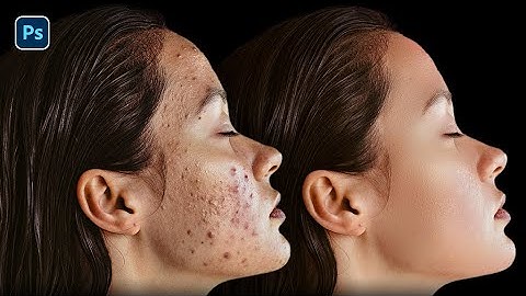 Remove pimples from face in photoshop | Easily remove acne blemishes pimples from face in photoshop