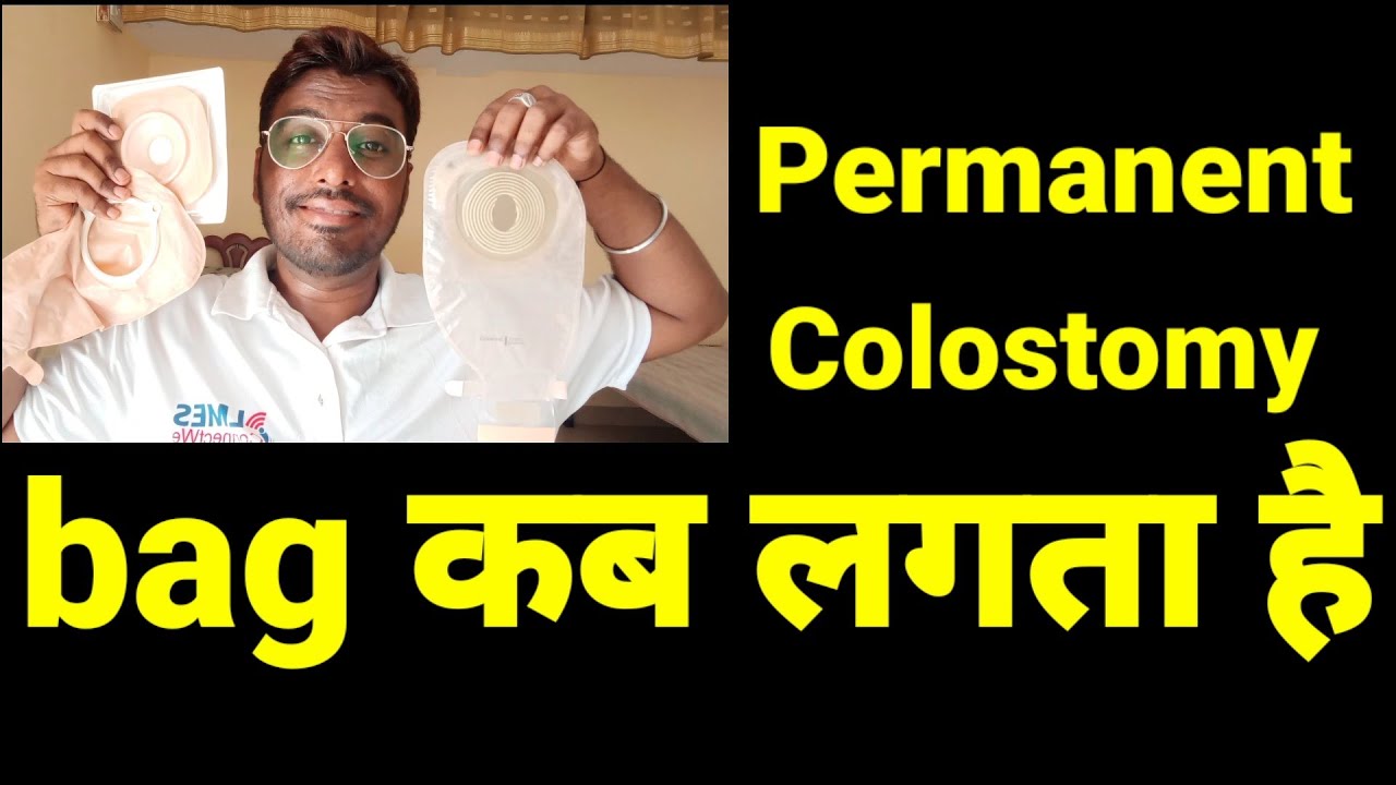 रेक्टल कैंसर में स्टोमा बॅग जरुरी है क्या ? Stoma Bag in Rectal