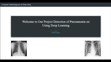 Pneumonia Detection Using CNN