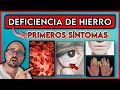 ESTOS son los PRIMEROS SINTOMAS de FALTA de HIERRO || ¿Cómo SABER si tienes el HIERRO BAJO?