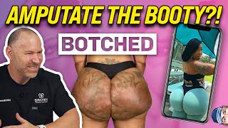Amputate the Booty?!