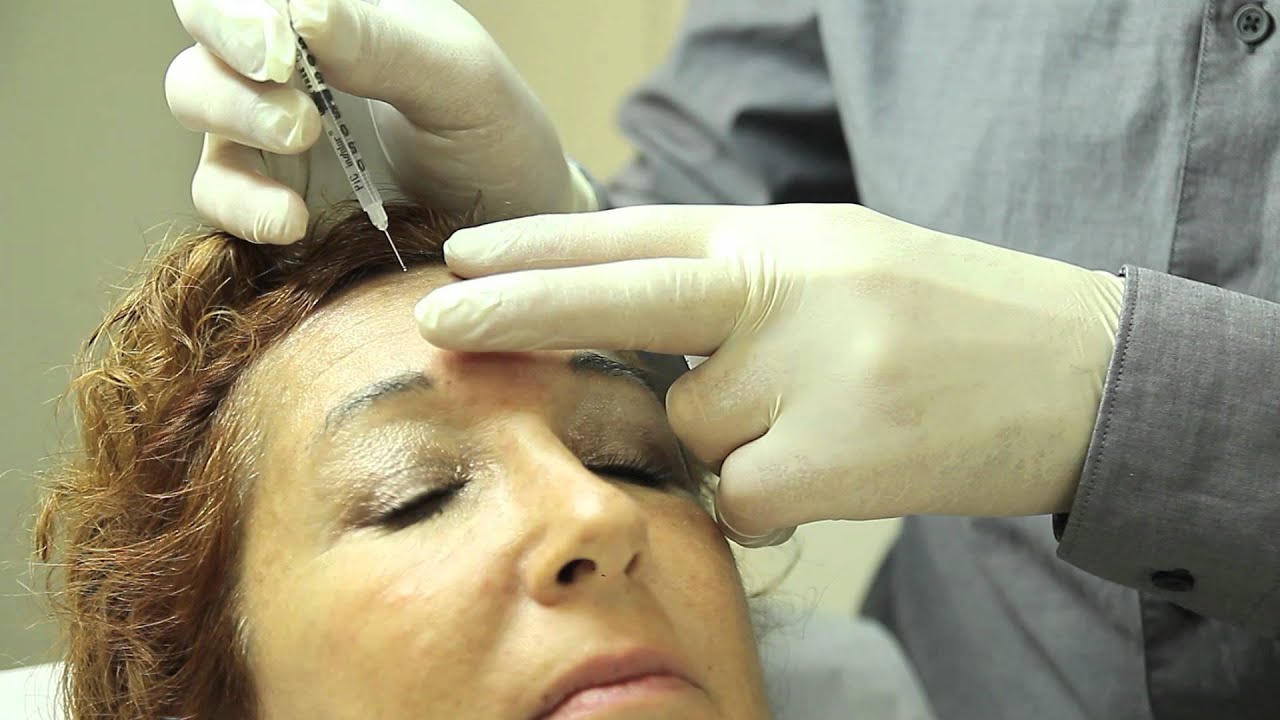 Injections de Botox ou toxine botulique : Technique et résultats