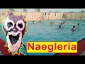 Naegleria - A Public Service Message