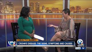 Crohn's Disease: Signs, Symptoms, Causes - Part 2