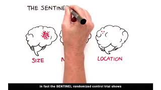 Physician Whiteboard Animation: Cerebral Embolic Debris Cascade and SENTINEL™ CPS