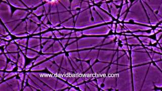 Neural Connection Formation by David Barlow 28,558 views 9 years ago 1 minute, 36 seconds