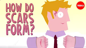 Will my scar ever turn white?
