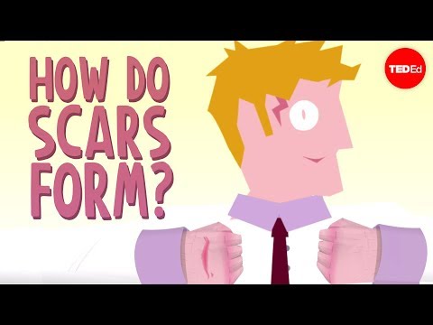 How do scars form? - Sarthak Sinha