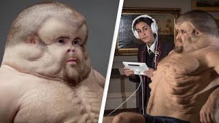 Evidence Reveals Surprising Answers: Are We Still Evolving?