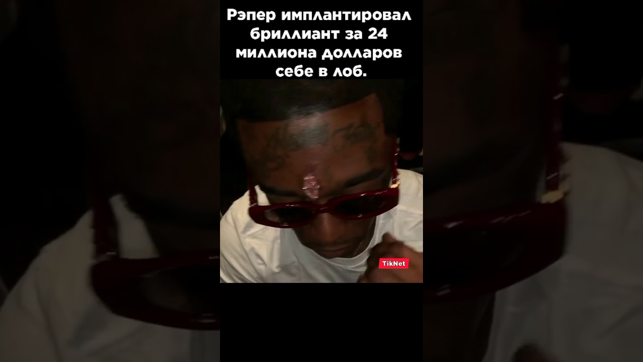 Рэпер имплантировал бриллиант за 24 миллиона долларов себе в лоб