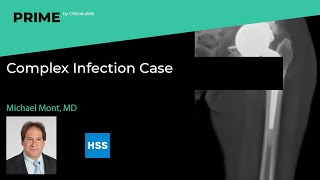 Complex Infection Case - Michael A. Mont, MD