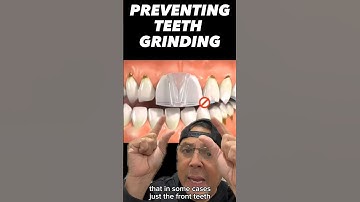 How to Prevent Teeth Grinding During Sleep (Wear an Occlusal Guard) | View Mobile Dental #shorts