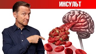 Как предсказать тихий инсульт?🤷‍♀️