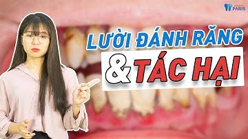 Lười đánh răng có tác hại khủng khiếp như thế nào? | Nha khoa Paris