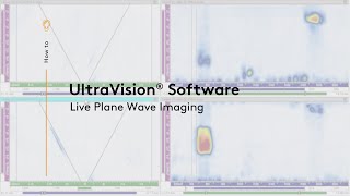 UltraVision® for Live Plane Wave Imaging screenshot 1