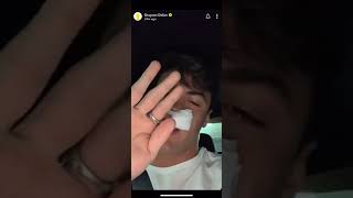 Grayson And Ethan Dolan After Surgery Snapchat