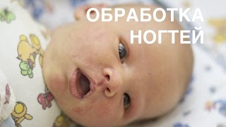 Как обрабатывать ноготочки новорожденных II ОВП