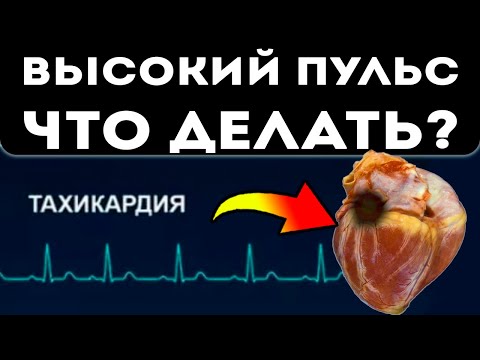 Высокий пульс, а давление в норме? Профилактика и народные методы