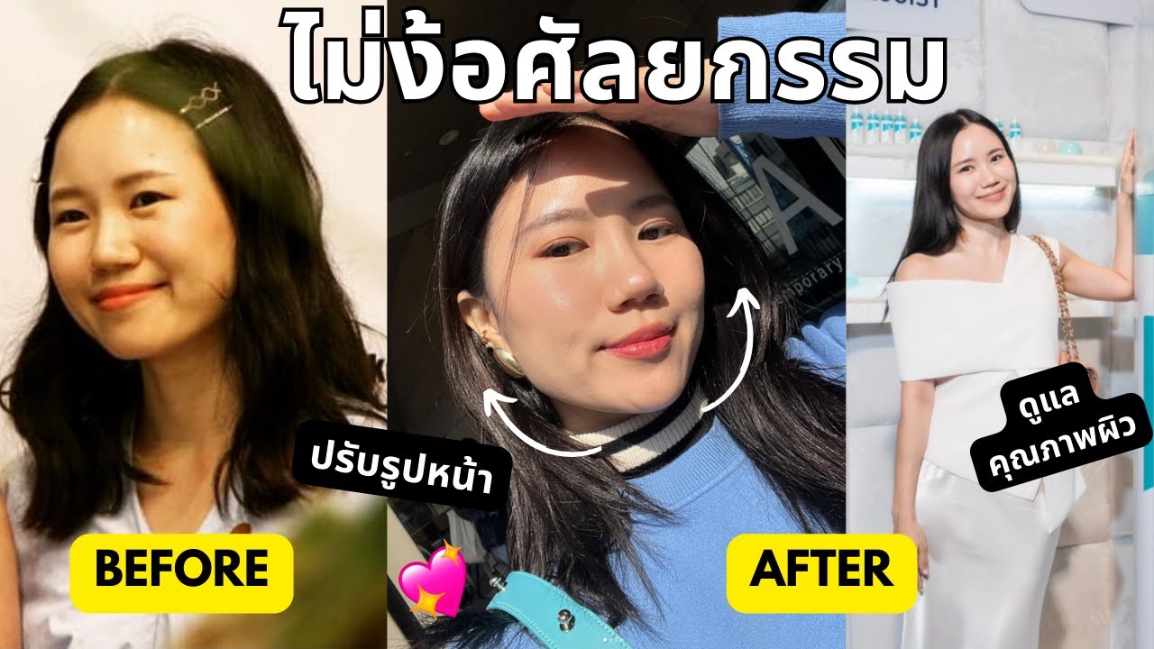 GLOW UP TIPS  สวยขึ้นยังไงแบบไม่พึ่งศัลยกรรม 💥 ชี้พิกัดโปรแกรมดูแลผิวหน้าที่เพิ่งไปทำมา!