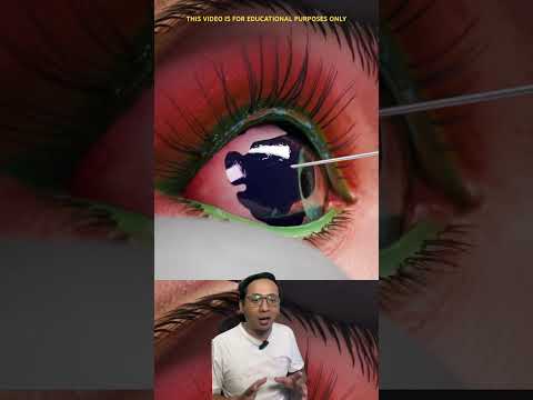 Tatto Mata Tidak Bisa Di Hapus 😭