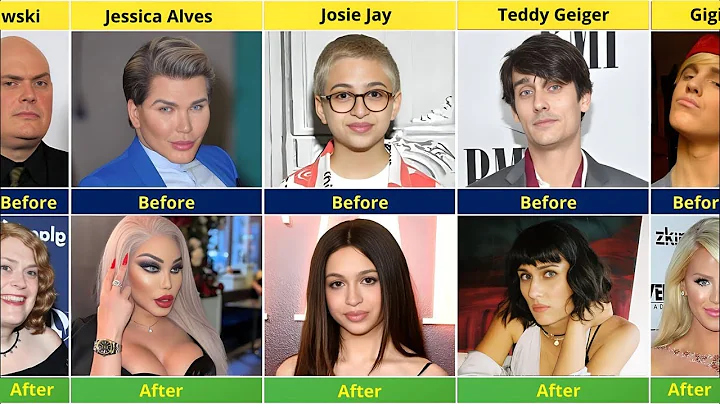 🌈 Shocking! Celebrities Who Underwent Gender Transition | Before and After
