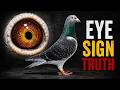 Pigeon Eye Sign: Myth or Secret Weapon?