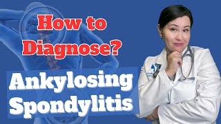 How to Diagnose Ankylosing spondylitis? | Dr. Diana Girnita