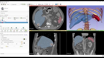 AI-assisted segmentation using free tools - 3D Slicer and Nvidia Clara