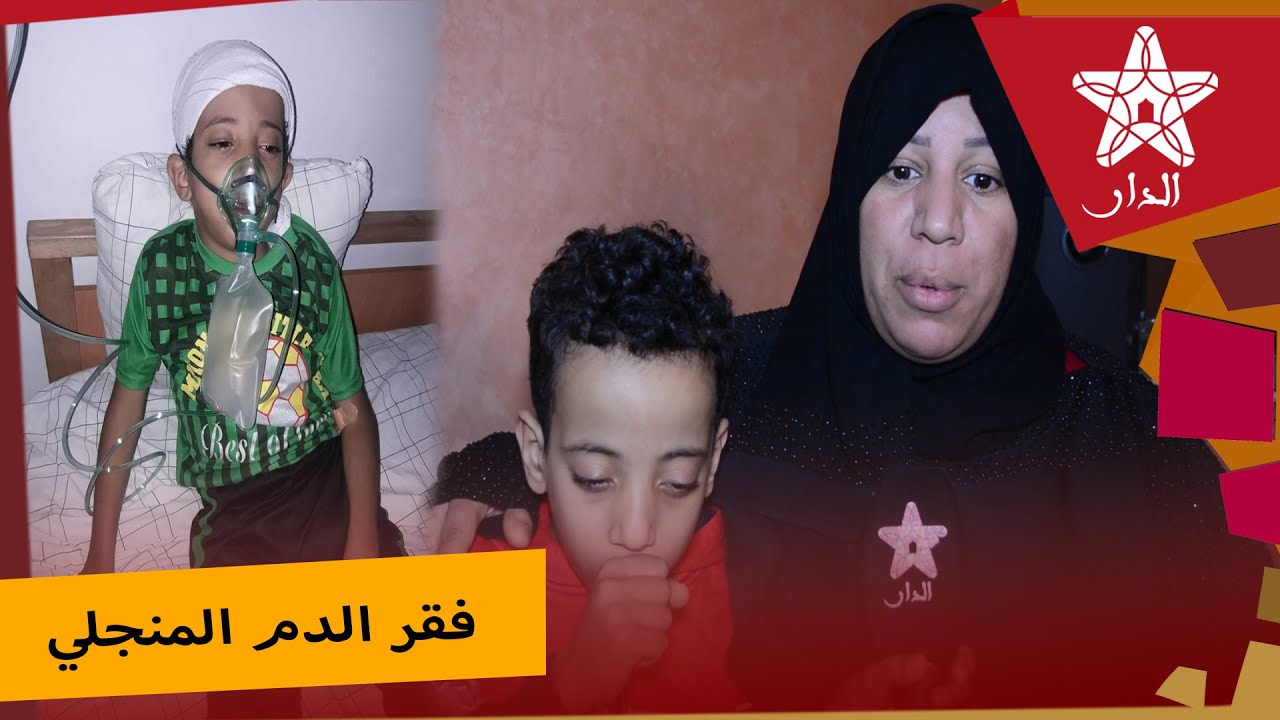 أم اياد المريض بفقر الدم المنجلي تتحدث عن معاناة ابنها وتحلم بتأسيس جمعية للتعريف بهذا المرض