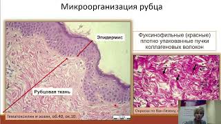 Елена БОРХУНОВА: Репаративная регенерация тканей, цитокины и Репарин-Хелпер