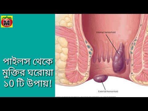 ভিডিও: অশ্বারোহীরা মানে কি?