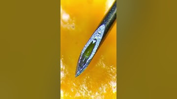 Used syringe under the microscope is insane (real!)