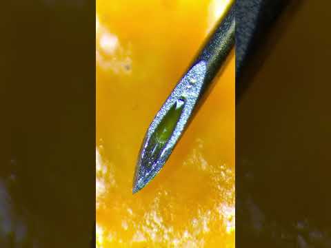 Used syringe under the microscope is insane (real!)