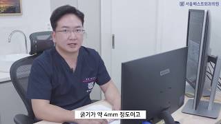 유방조직검사방법은 어떤게 있나요 닥터정 원장이 쉽게 알려드릴게요