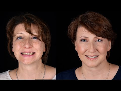 Wideo: Dlaczego Marzyłem O Spadających Zębach
