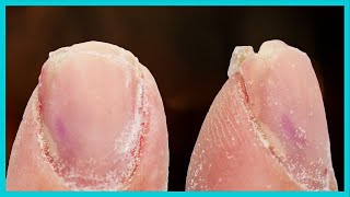 Fix Broken Glued Ugly Nail