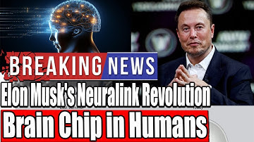 Unlock the Mind: Elon Musk