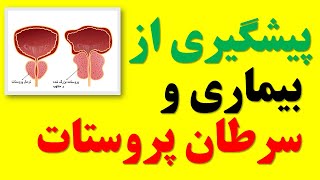 اقدامات اساسی برای پیشگیری از بیماری و سرطان پروستات