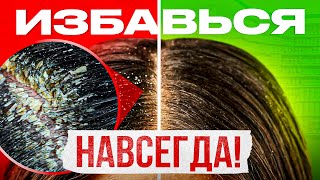 Перхоть. 5 причин перхоти. Избавься от перхоти навсегда!