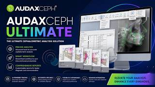 AudaxCeph Ultimate 6.6.12.4731 || 2023 ||